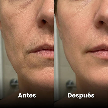 Repara tu Piel en 7 días Sin Cremas Caras