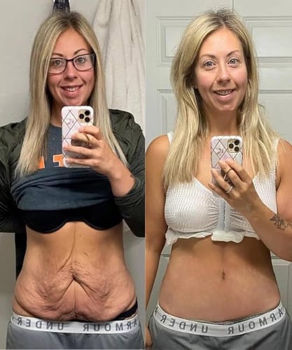 <h2>Mujeres Reales. Resultados Reales.</h2>