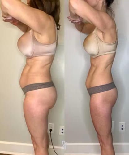 <h2>Mujeres Reales. Resultados Reales.</h2>